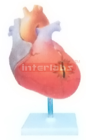 LEFT VENTRICULAR HYPERTROPHY MODEL